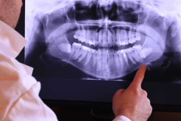 Best Emergency Dentist for Knocked-Out Tooth in Springs, NY